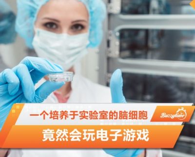 脑细胞
